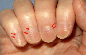体内有癌，手指先知？注意：手指出现这些症状，可能是疾病的信号