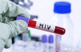 为什么艾滋病的症状不断，检查却是阴性的呢？